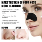 kf-S72c1c7f2cadb4ae793e2bed03c0ccb28Q-Peel-Off-Blackheads-Remove-Plaster-Nose-Strips-Pull-Black-Mask-for-Women-Beauty-Oily-Skin-Face