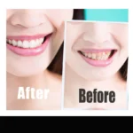 kf-Sc7692a9f52294f109900547c23ae5c358-14pcs-box-Teeth-Whitening-Strip-Charcoal-Teeth-Whitening-Strips-Remove-Coffee-Tea-Stains-Tooth-Whitening-Kit